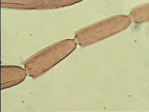 acutipennis Htype 10.jpg