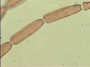 acutipennis Htype 9.jpg