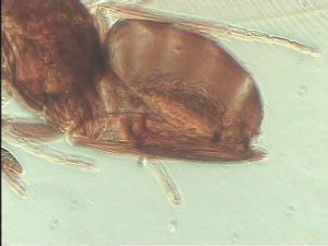 pectoralis Ltype 11.jpg