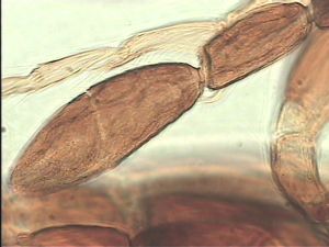 pectoralis Ltype 17.jpg