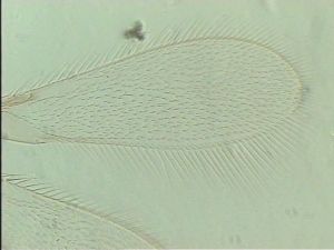 pectoralis Ltype 2.jpg