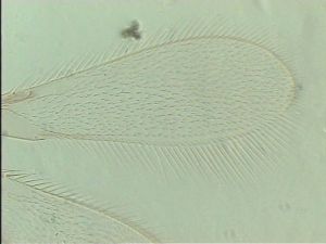 pectoralis Ltype 3.jpg