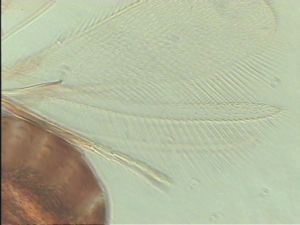 pectoralis Ltype 4.jpg