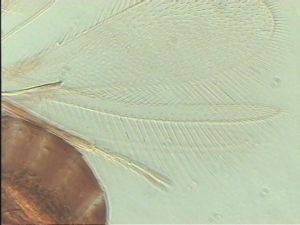 pectoralis Ltype 5.jpg