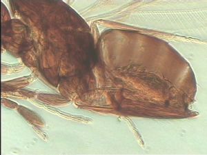 pectoralis Ltype 7.jpg