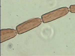 aterrima Htype 11.jpg