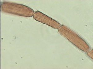 aterrima Htype 15.jpg