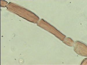 aterrima Htype 16.jpg