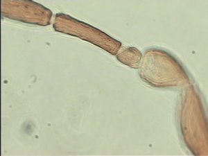 aterrima Htype 8.jpg