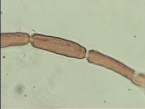 aterrima Htype 9.jpg