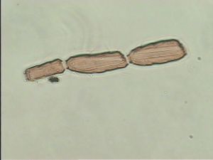 collinus Ltype 5.jpg