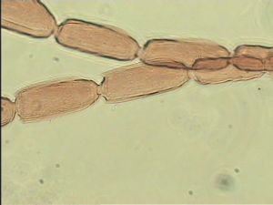 discolorsimilis Htype 9.jpg