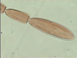 nigerrima Htype 11.jpg