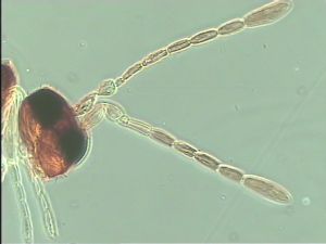 nigerrima Htype 5.jpg