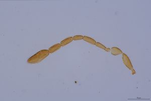 stubaiensis Htype 0-2.jpg