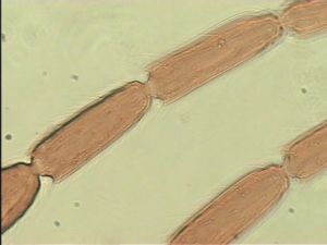 dilatata 'Type' 11.jpg