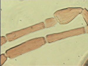 dilatata 'Type' 9.jpg