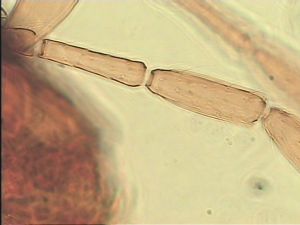 gracillimus Htype 7.jpg