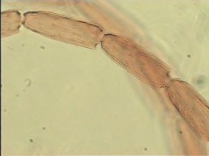 gracillimus Htype 8.jpg