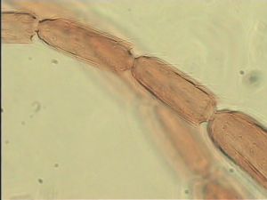 gracillimus Htype 9.jpg