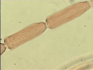 luteicornis Htype 9.jpg