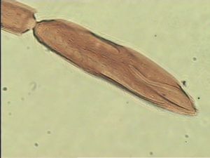 neoserenus Htype 10.jpg