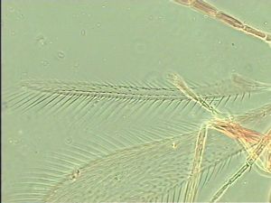 neoserenus Htype 3.jpg