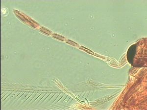 neoserenus Htype 5.jpg