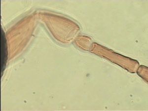 neoserenus Htype 7.jpg