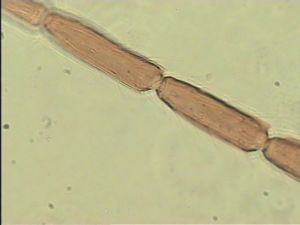 neoserenus Htype 8.jpg