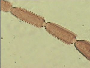 neoserenus Htype 9.jpg