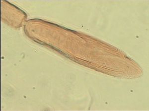 serenus Htype 10.jpg