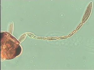 siegerfeldi Htype 5.jpg