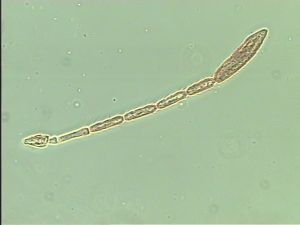 siegerfeldi Htype 6.jpg