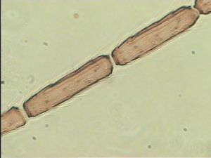 siegerfeldi Htype 8.jpg