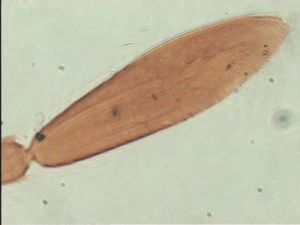 tarsalis Htype 10.jpg