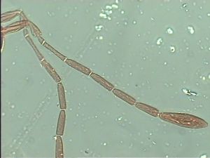 tarsalis Htype 3.jpg