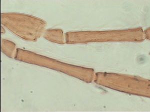 tarsalis Htype 5.jpg