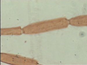 tarsalis Htype 6.jpg