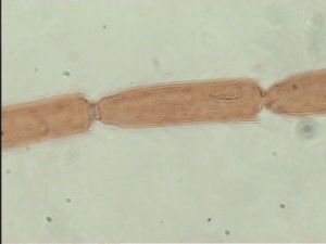 tarsalis Htype 7.jpg