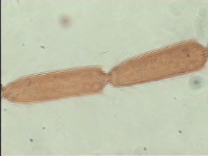 tarsalis Htype 8.jpg