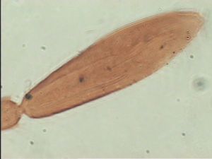 tarsalis Htype 9.jpg