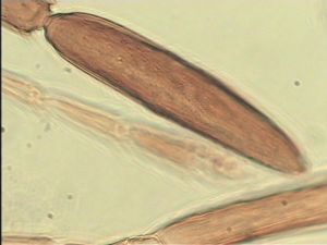 thoracicus Htype 11.jpg