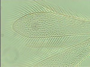 thoracicus Htype 3.jpg