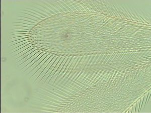 thoracicus Htype 4.jpg