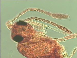 thoracicus Htype 6.jpg