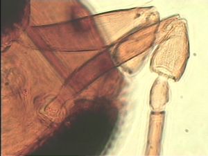 thoracicus Htype 7.jpg