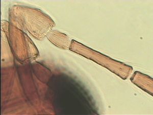 thoracicus Htype 8.jpg