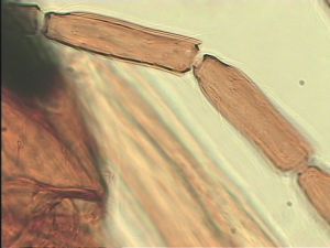 thoracicus Htype 9.jpg