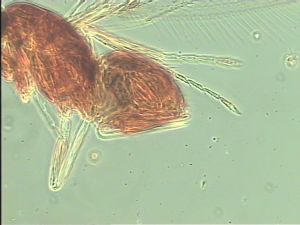 superaddita Htype 14.jpg